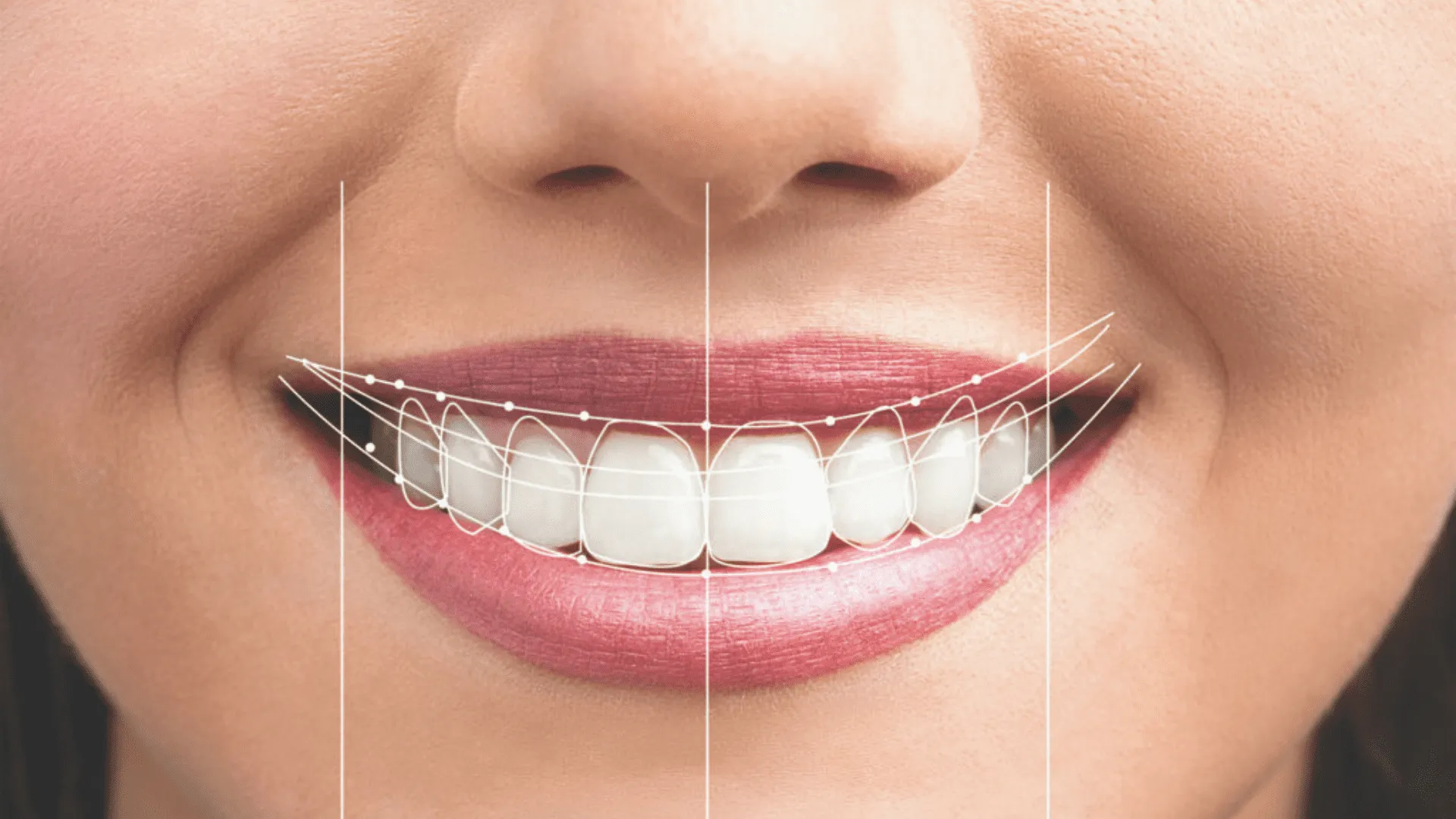 El Diseño de Sonrisa: Arte y Tecnología 3D
