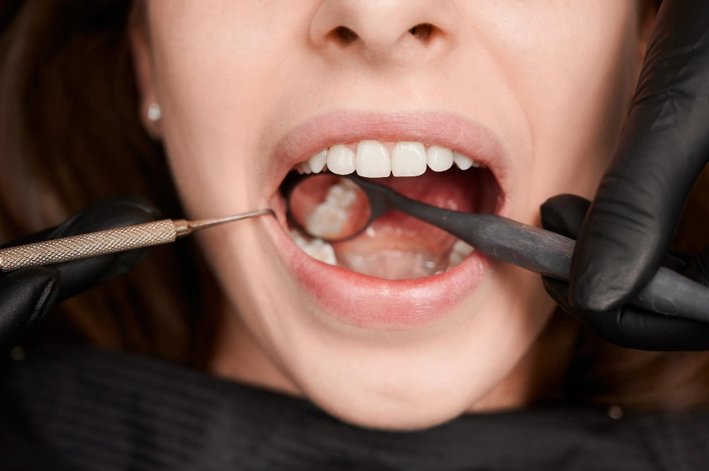Endodoncia: Salvando tu diente natural