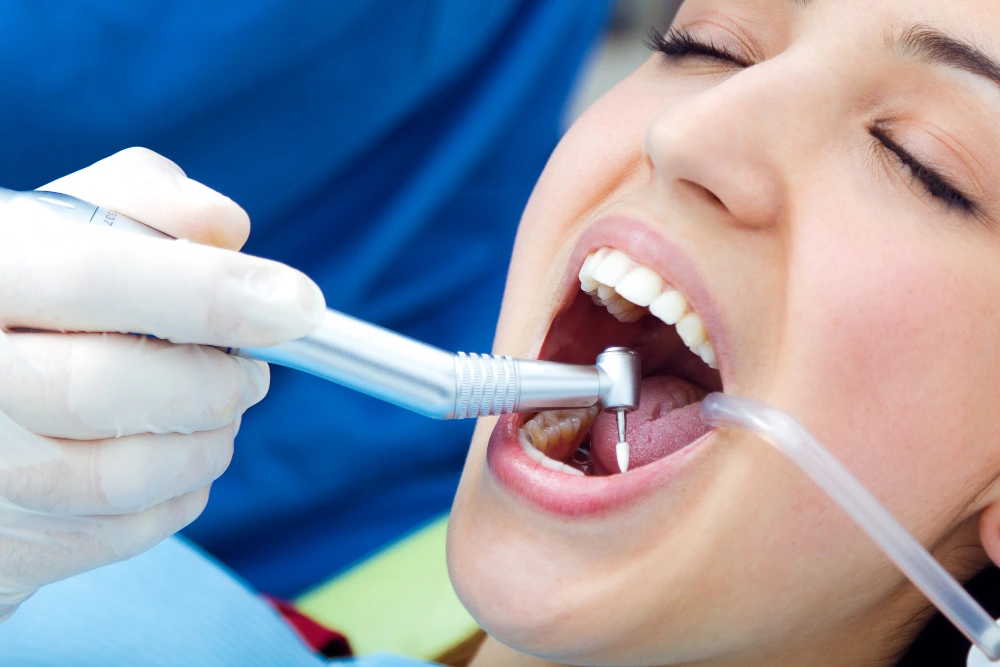Limpieza y Blanqueamiento: El brillo natural de tu sonrisa